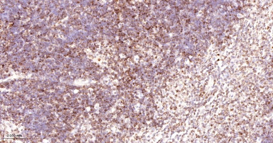 14 - SUN2 Recombinant Rabbit mAb AP94778