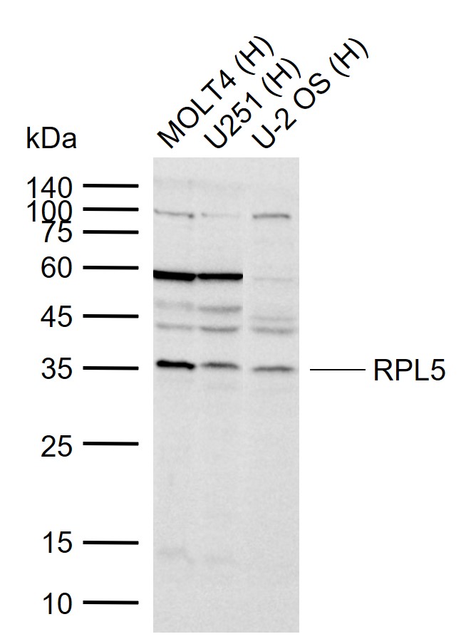 1 - RPL5 Rabbit pAb AP94785