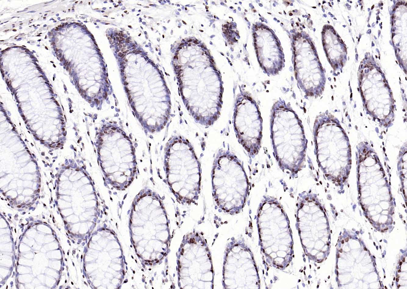 14 - RPL5 Rabbit pAb AP94785