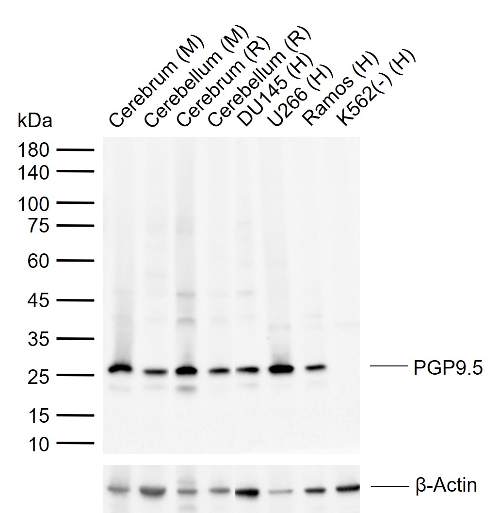 1 - PGP9.5 Mouse mAb AP94790