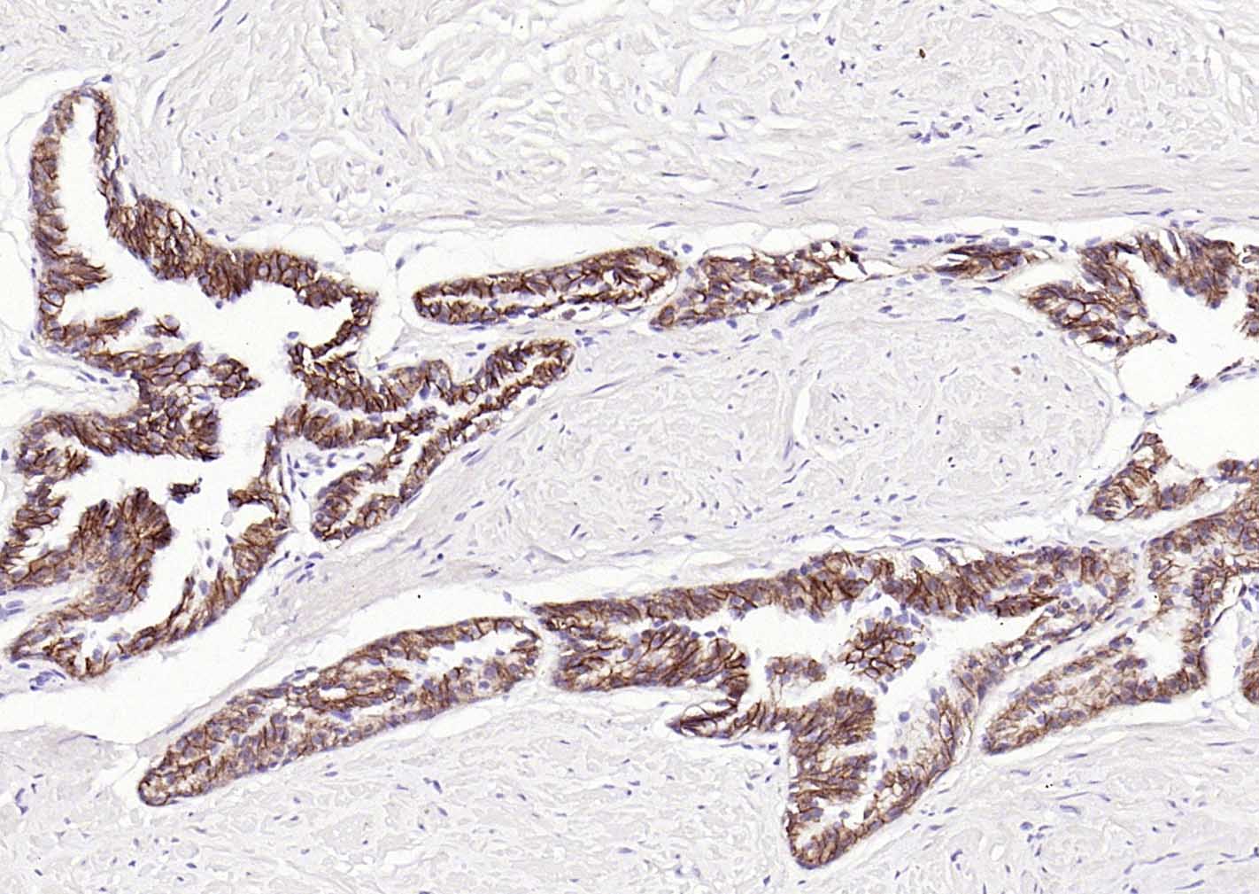 14 - CTNND1 Mouse mAb AP94791