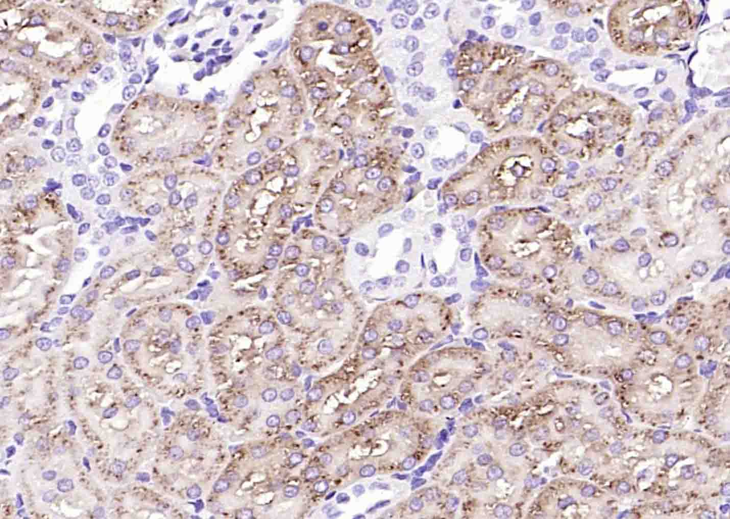 14 - NAPSIN A Mouse mAb AP94794