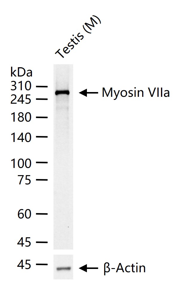 1 - Myosin VIIa Recombinant Rabbit mAb AP94796