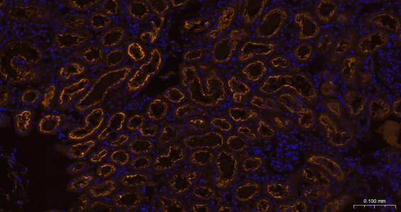 3 - LRP2 Recombinant Rabbit mAb AP94798