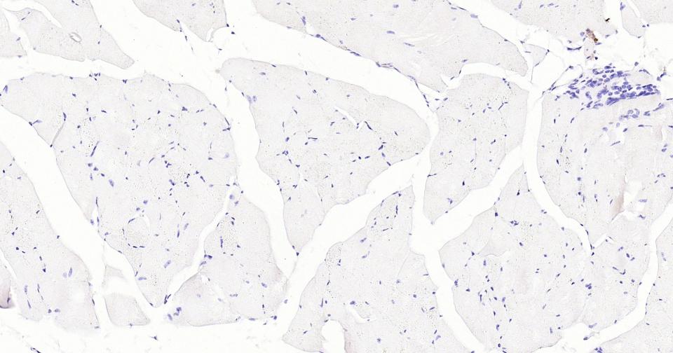 14 - LRP2 Recombinant Rabbit mAb AP94798