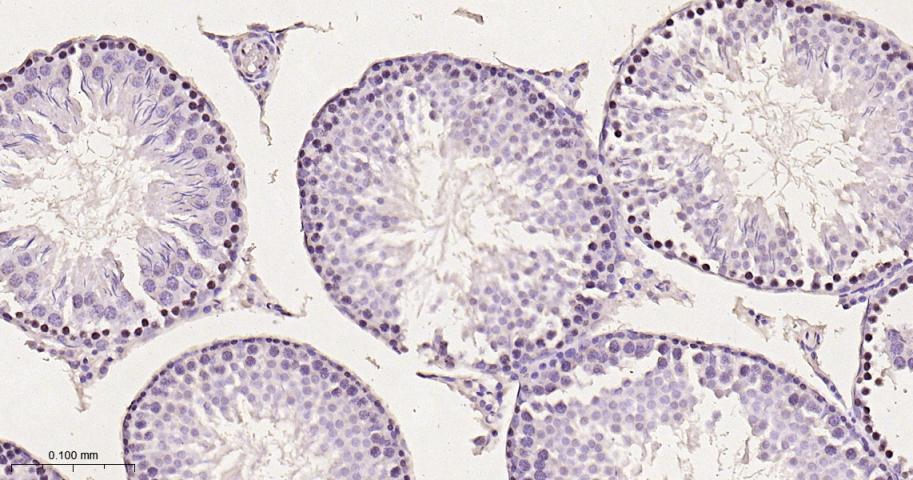 14 - Acetyl Lysine Recombinant Rabbit mAb AP94800