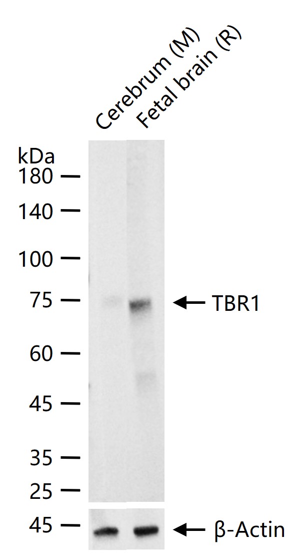 1 - TBR1 Recombinant Rabbit mAb AP94802