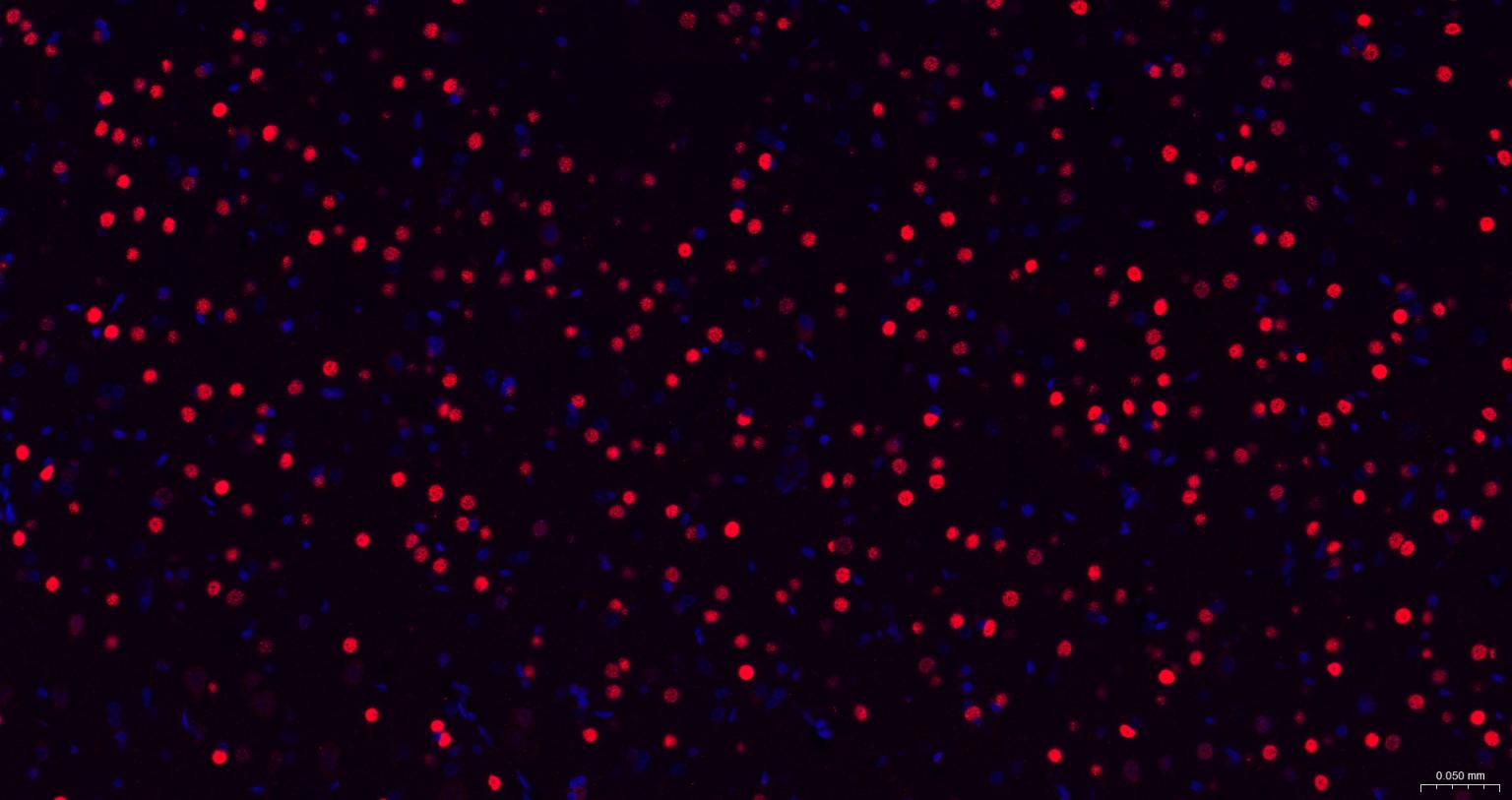 3 - TBR1 Recombinant Rabbit mAb AP94802