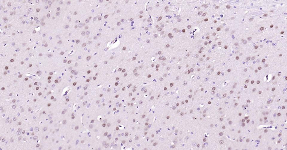 14 - TBR1 Recombinant Rabbit mAb AP94802