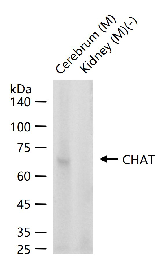 1 - CHAT Mouse mAb AP94804