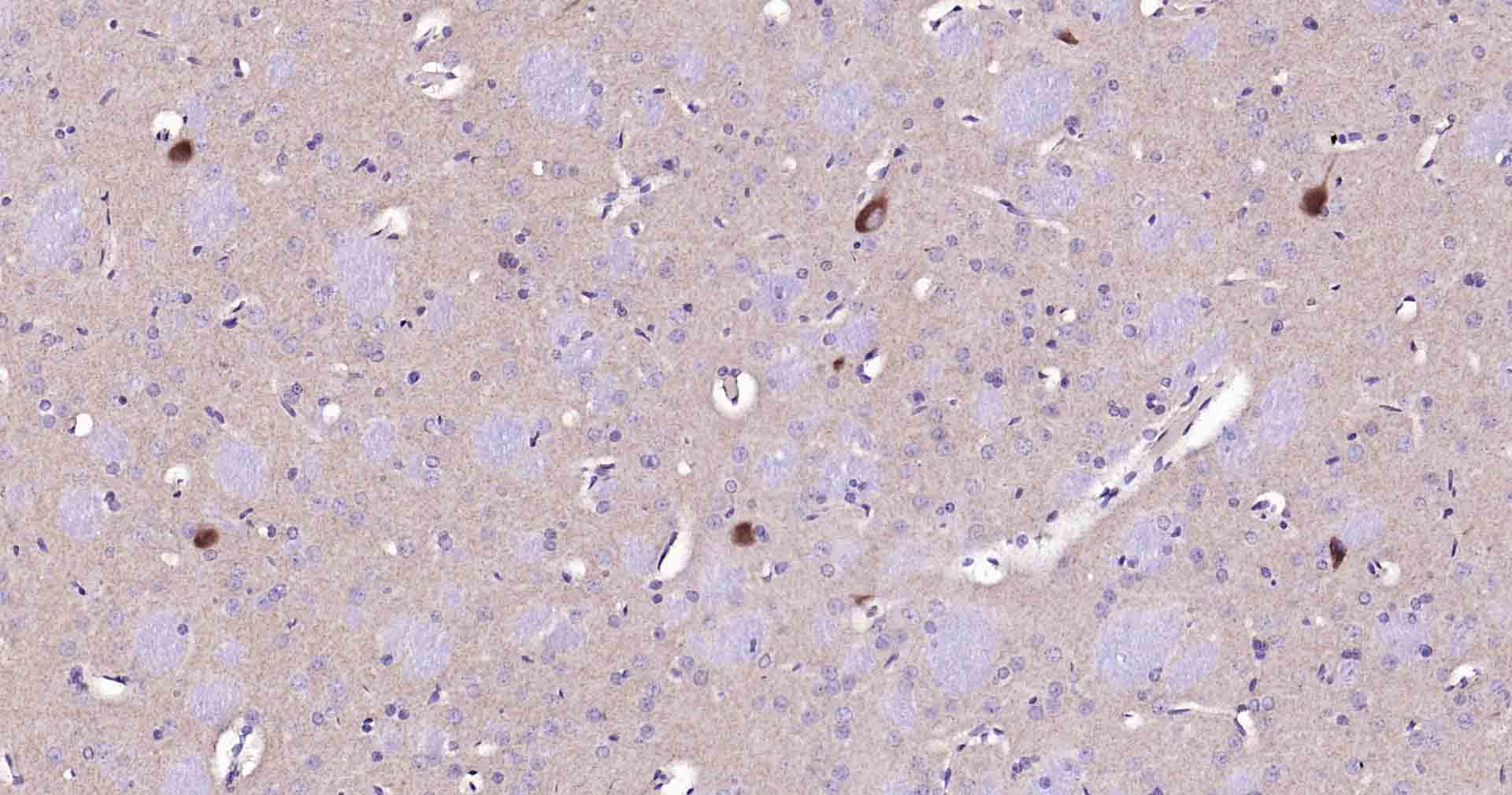 14 - CHAT Mouse mAb AP94804