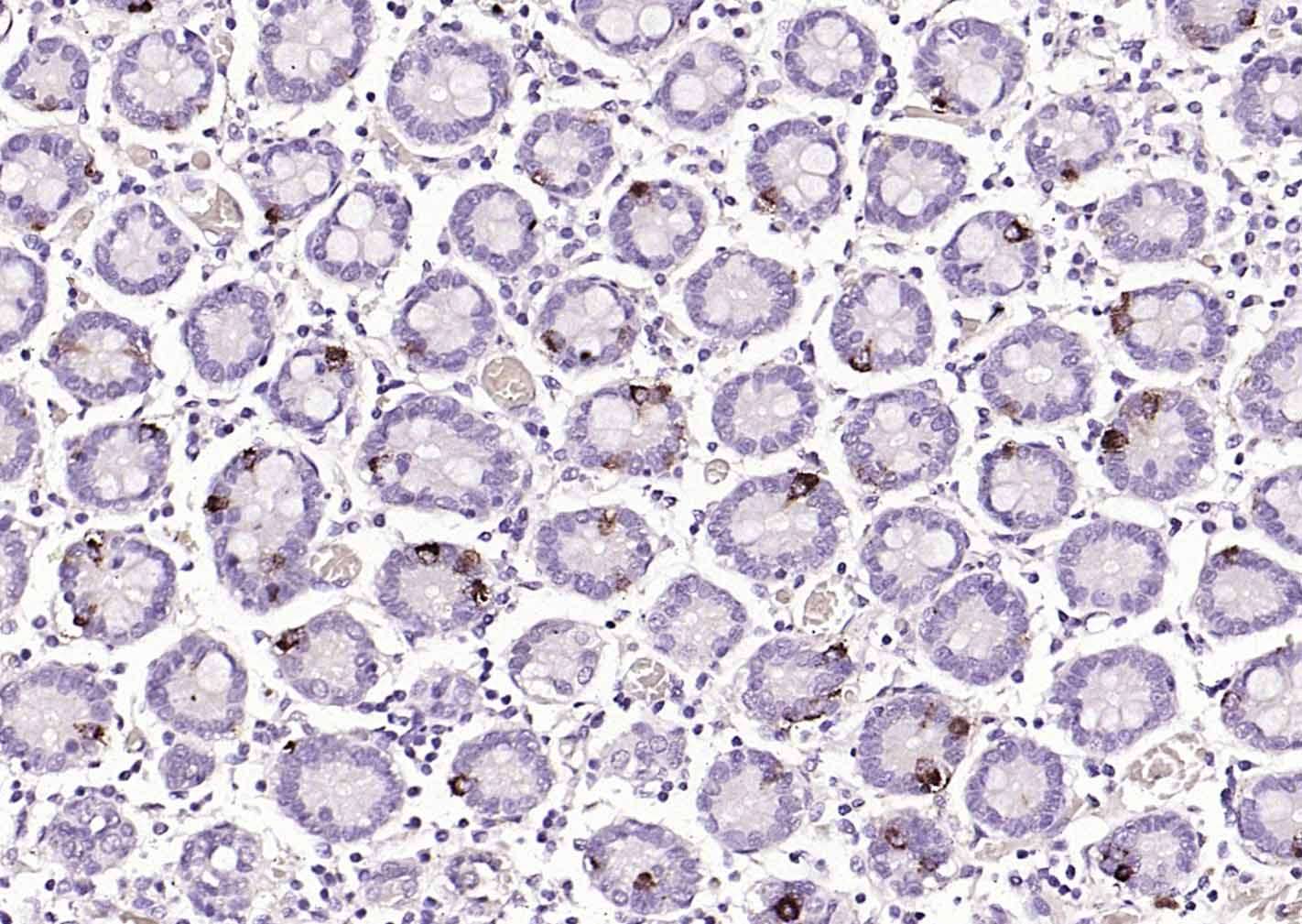 14 - CHGA Rabbit pAb AP94805