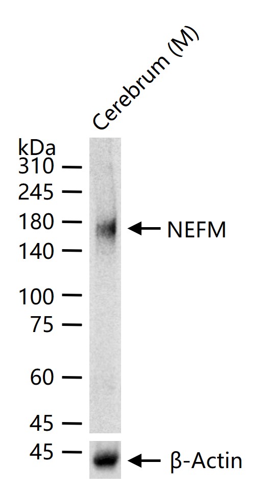 1 - NEFM Recombinant Mouse mAb AP94808