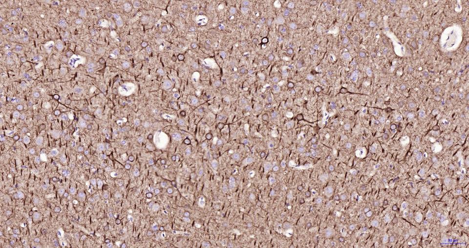 14 - NEFM Recombinant Mouse mAb AP94808