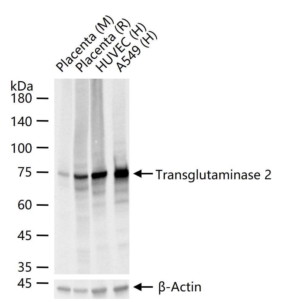 1 - Transglutaminase 2 Recombinant Rabbit mAb AP94809