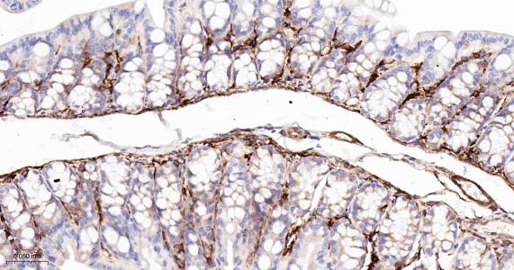 14 - Transglutaminase 2 Recombinant Rabbit mAb AP94809