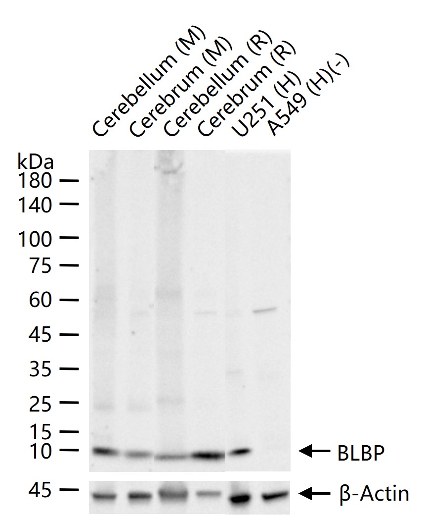1 - BLBP Recombinant Mouse mAb AP94810