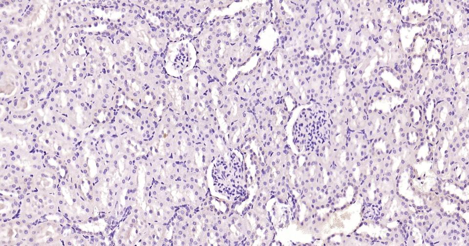 14 - BLBP Recombinant Mouse mAb AP94810