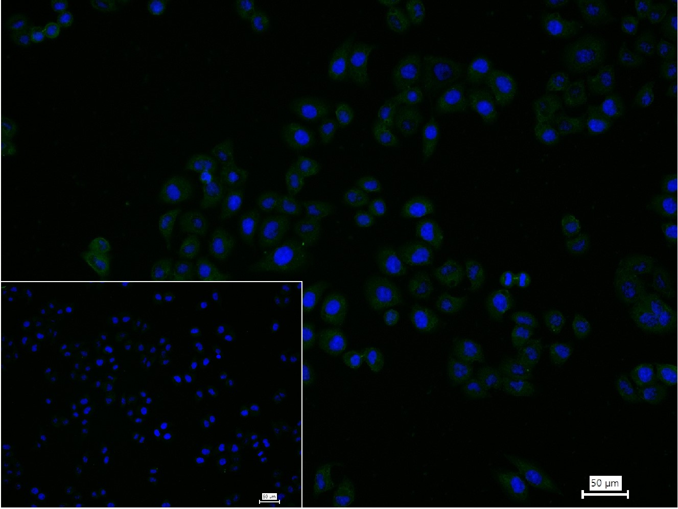 0 - hUPF1 Recombinant Rabbit mAb AP94811