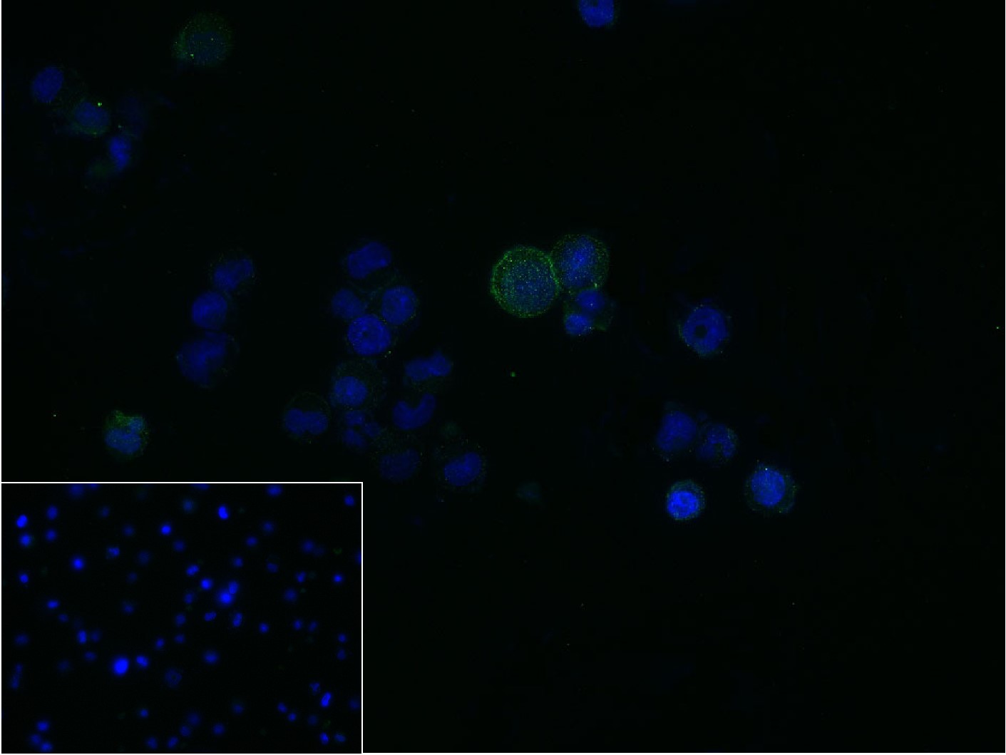 0 - PR3 Mouse mAb AP94814