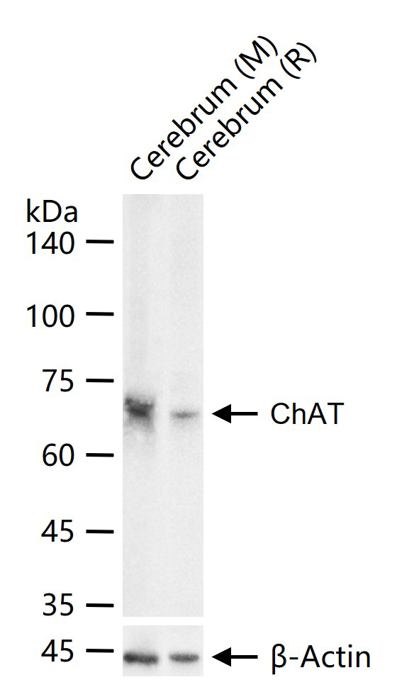 1 - CHAT Recombinant Rabbit mAb AP94815