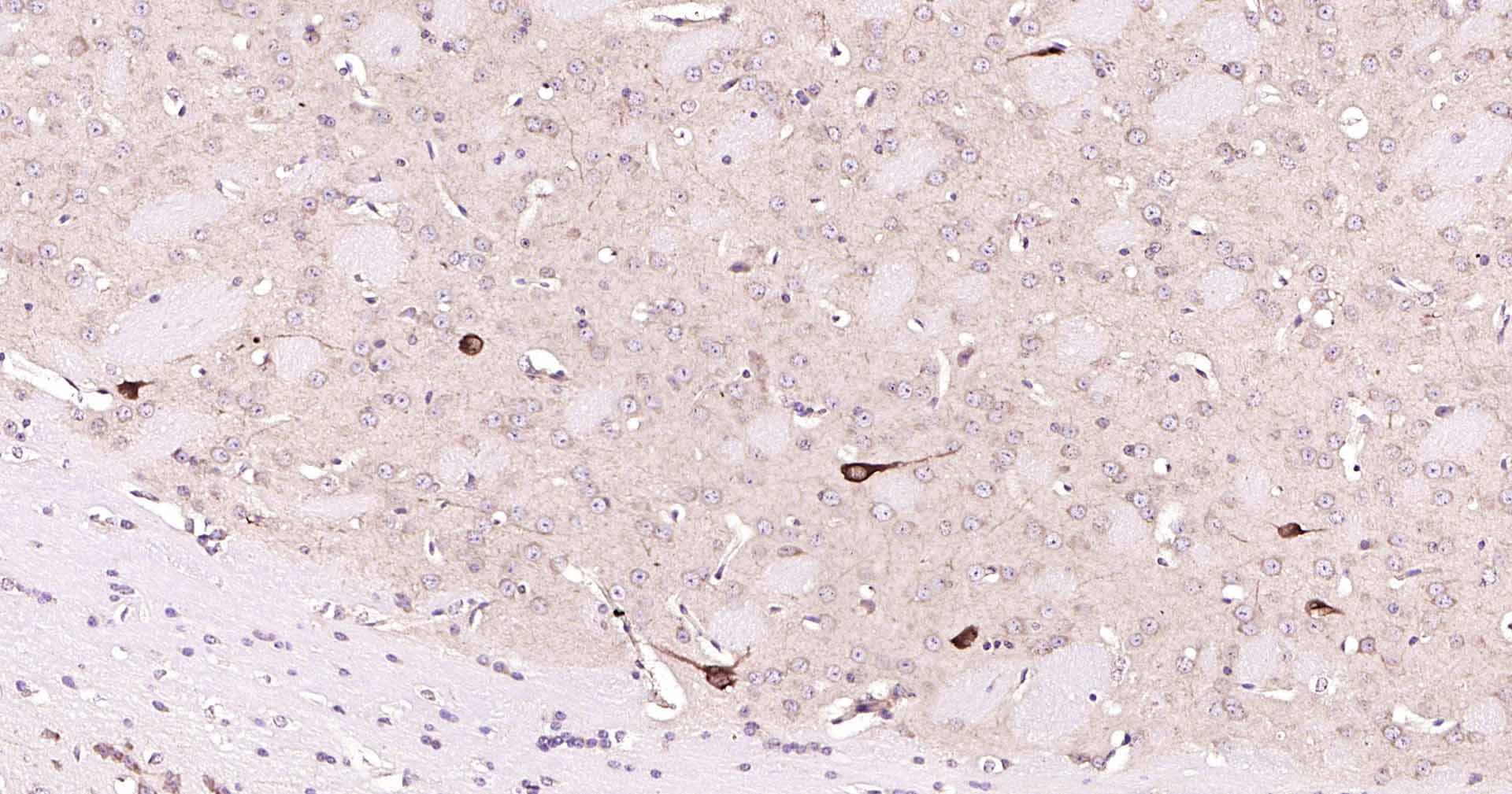 14 - CHAT Recombinant Rabbit mAb AP94815