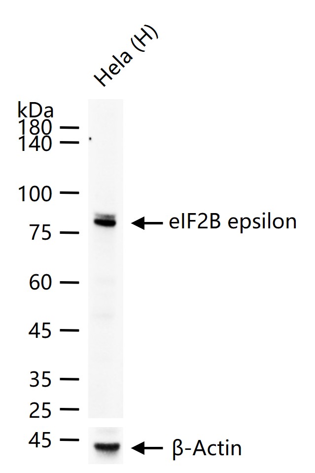 1 - eIF2B epsilon Recombinant Rabbit mAb AP94816