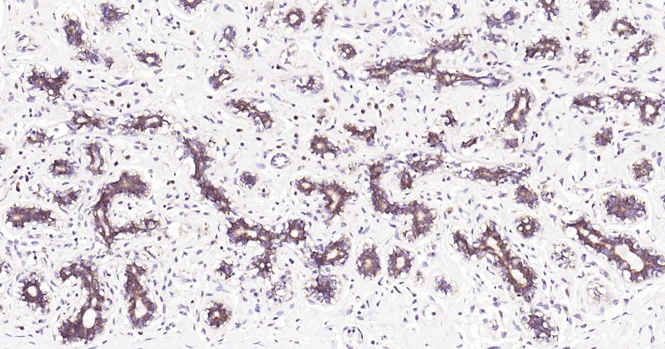 14 - eIF2B epsilon Recombinant Rabbit mAb AP94816