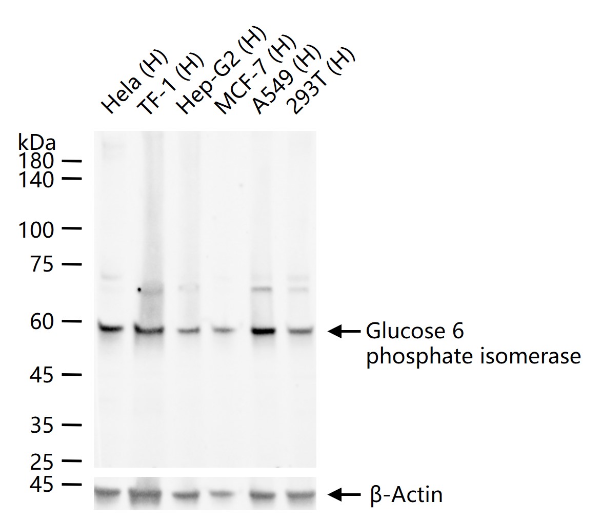 1 - Glucose 6 phosphate isomerase Recombinant Rabbit mAb AP94817