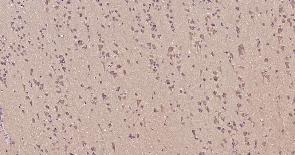 14 - Glucose 6 phosphate isomerase Recombinant Rabbit mAb AP94817