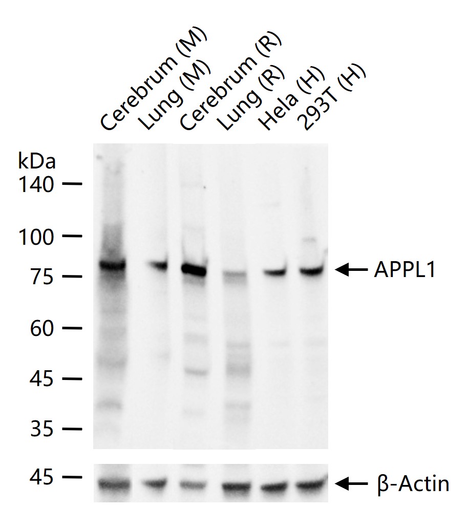 1 - APPL1 Recombinant Rabbit mAb AP94818
