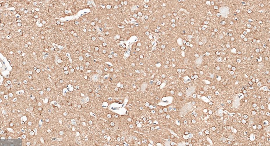 14 - APPL1 Recombinant Rabbit mAb AP94818