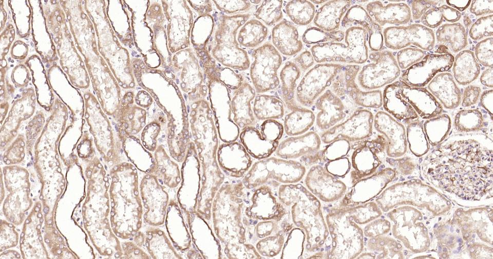 14 - PIK3R3 Recombinant Rabbit mAb AP94820