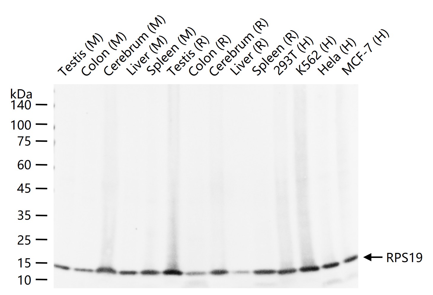 1 - RPS19 Recombinant Rabbit mAb AP94822