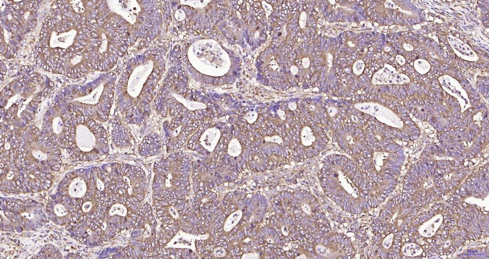 14 - RPS19 Recombinant Rabbit mAb AP94822