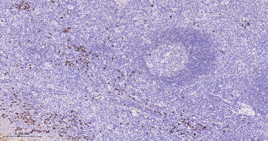 14 - Human IgG Recombinant Rabbit mAb AP94825