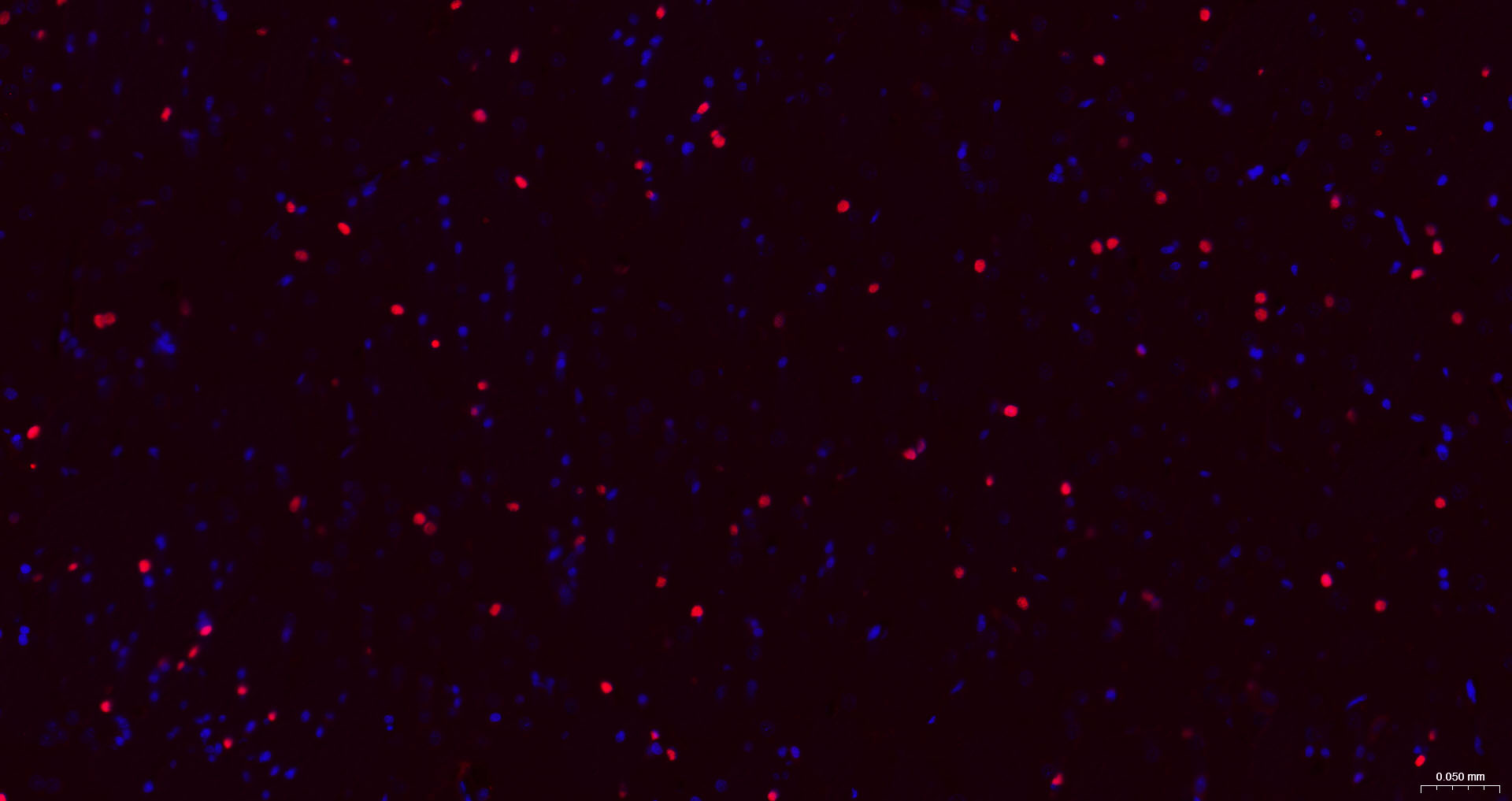 3 - SOX9 Recombinant Rabbit mAb AP94827