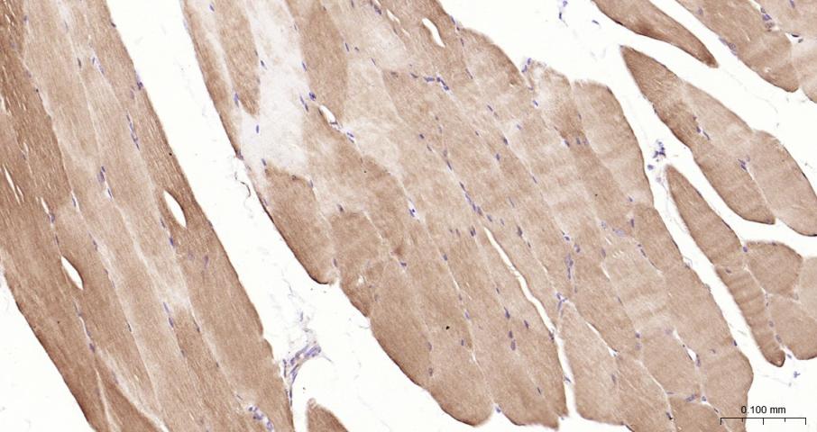 14 - LDHA Recombinant Rabbit mAb AP94838