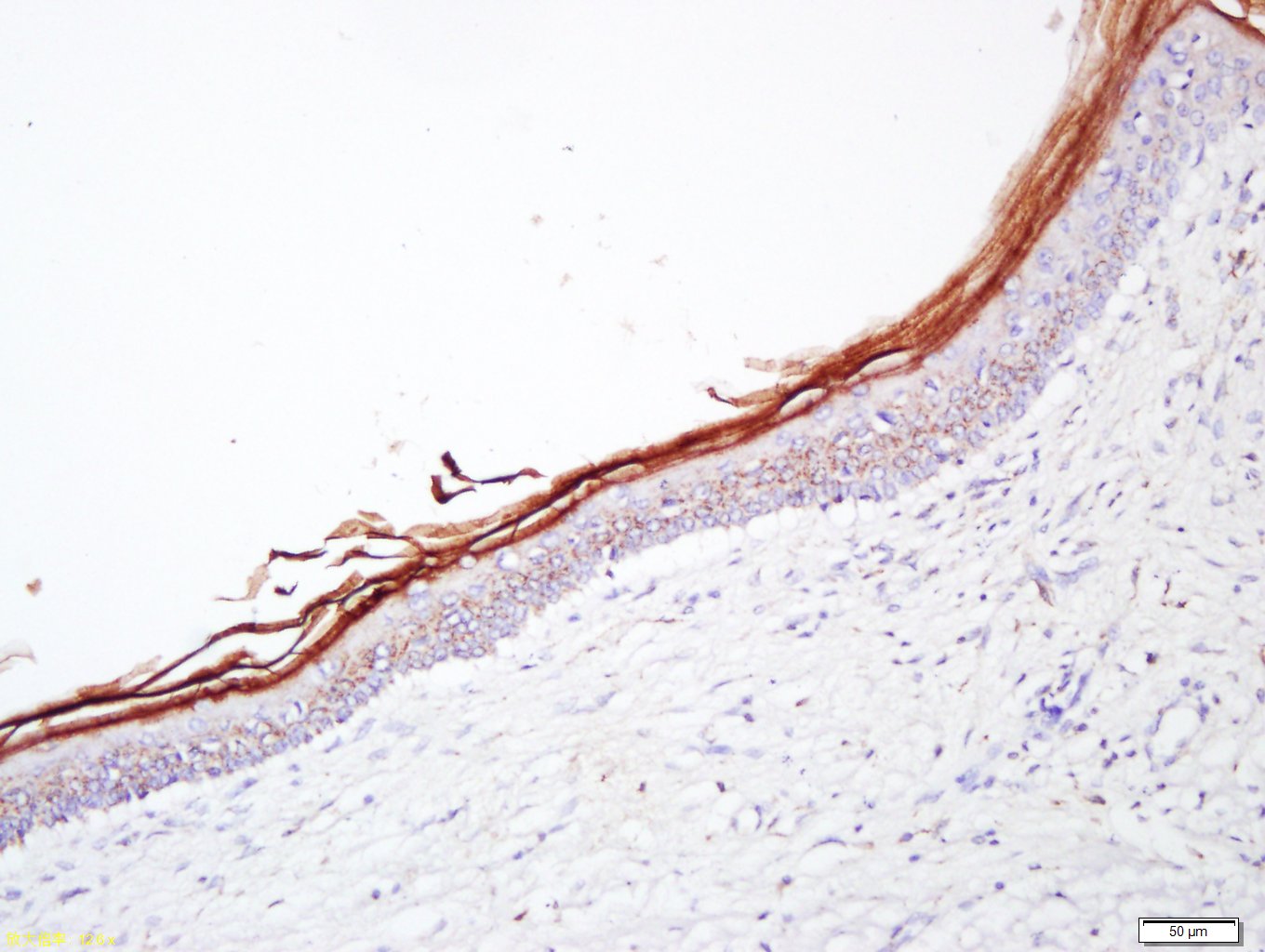 14 - Filaggrin Rabbit pAb AP94843