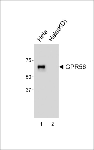 1 - GPR56 Antibody [Knockdown Validated] AW5511