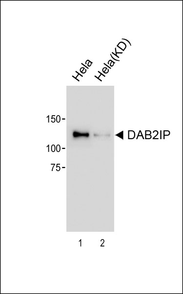 1 - DAB2IP Antibody [Knockdown Validated] AM8524b