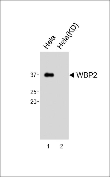 1 - WBP2 Antibody (C-term)[Knockdown Validated] AM8599b