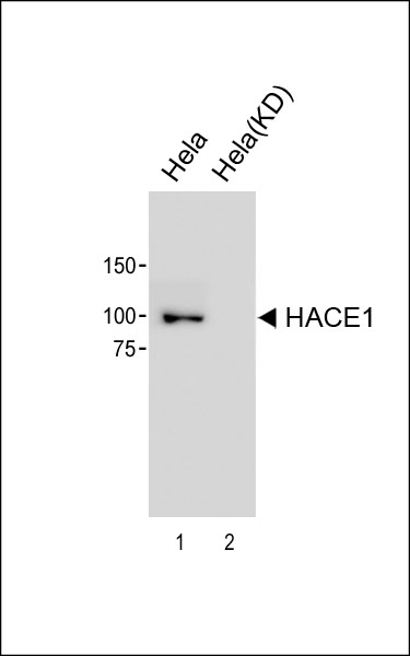 1 - HACE1 Antibody [Knockdown Validated] AM8644b