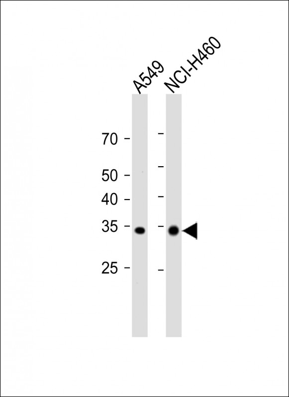 1 - FAM26F Antibody (C-term) AP20331b