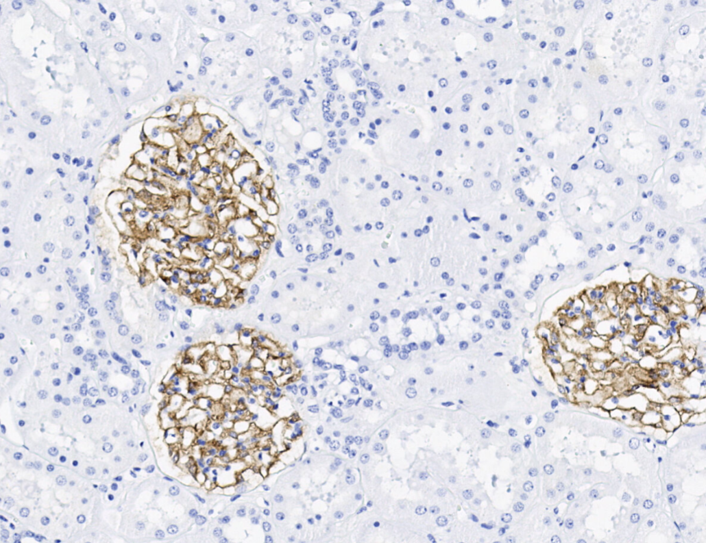 14 - PLA2R antibody AD80010