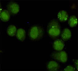3 - GTF2H1 (3E8) Mouse mAb AP53494
