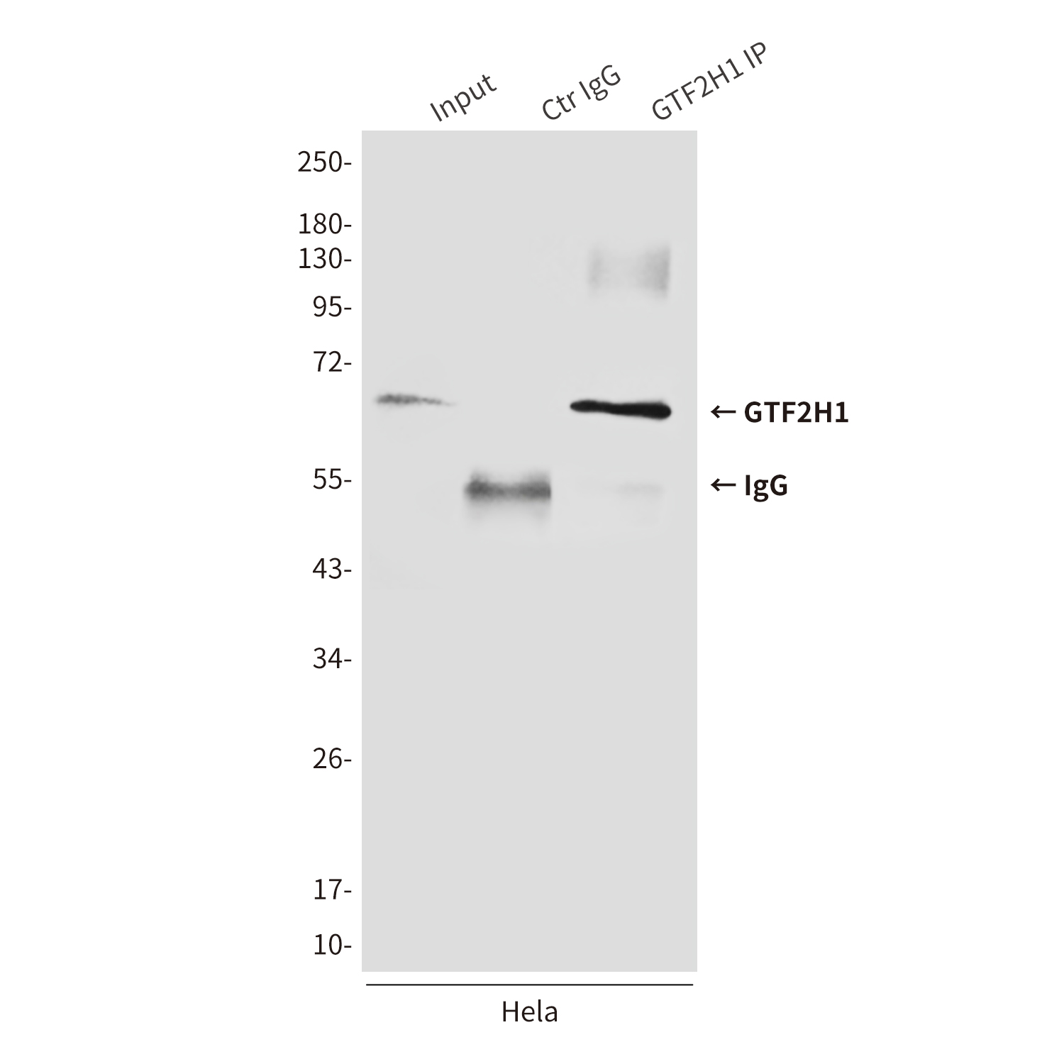 5 - GTF2H1 (3E8) Mouse mAb AP53494