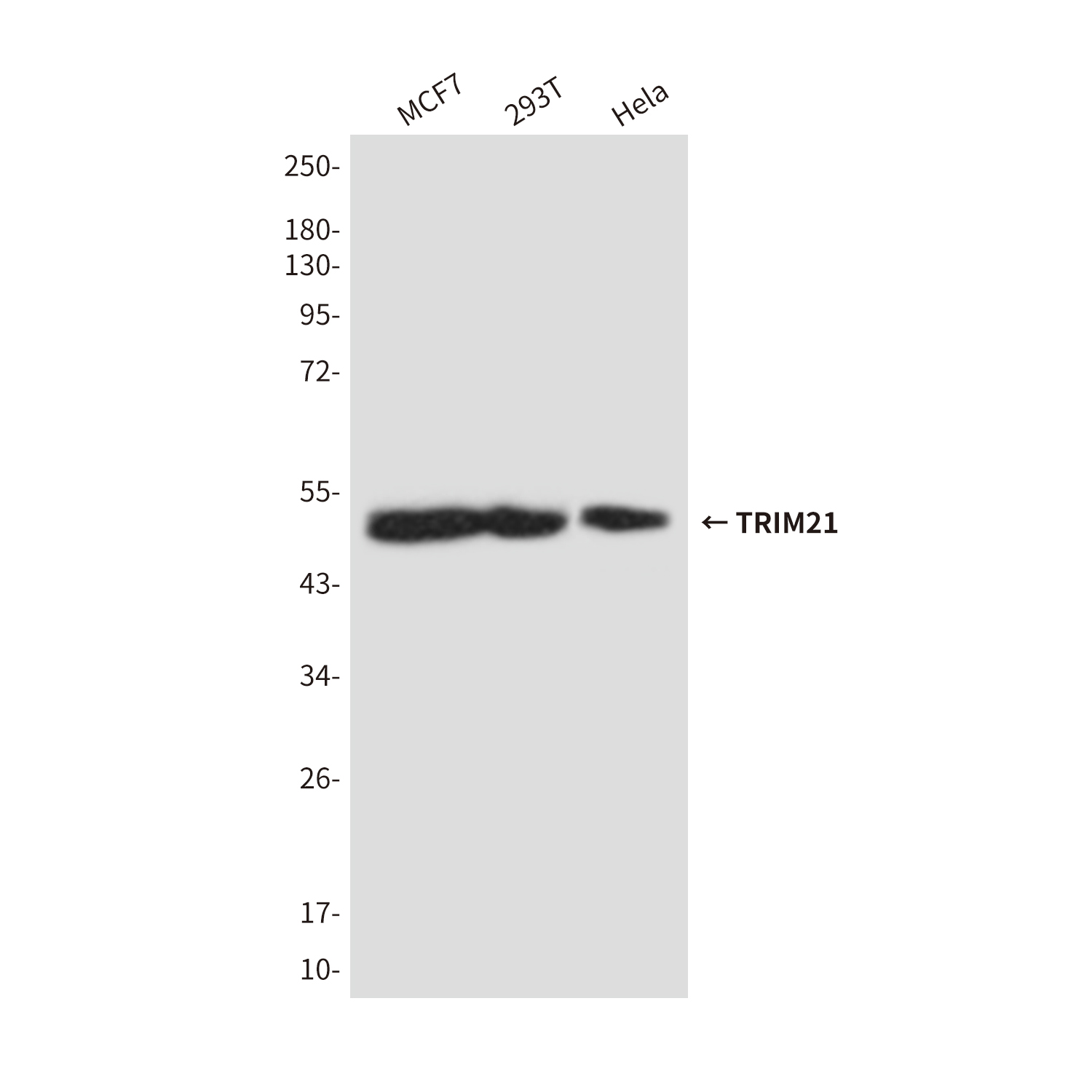 1 - TRIM21 (5B9) Mouse mAb AP53520
