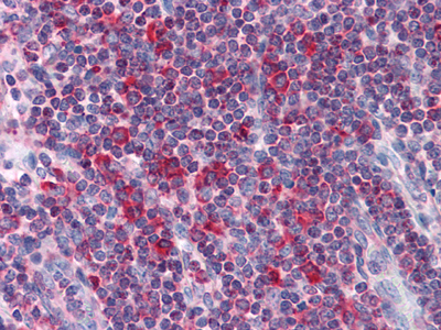 4 - LYRIC/AEG1 (2E4) Mouse mAb AP53503