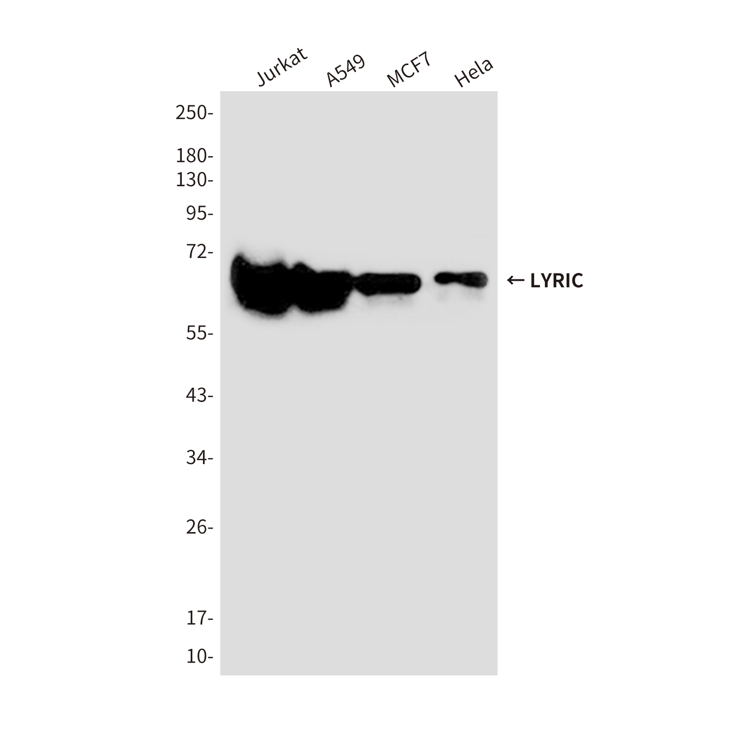 1 - LYRIC/AEG1 (2E4) Mouse mAb AP53503